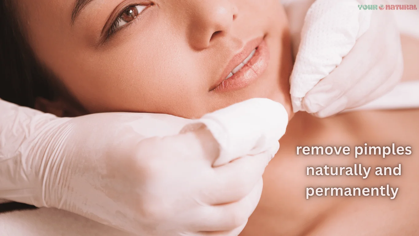Close-up of a woman receiving a facial treatment to remove pimples naturally and permanently